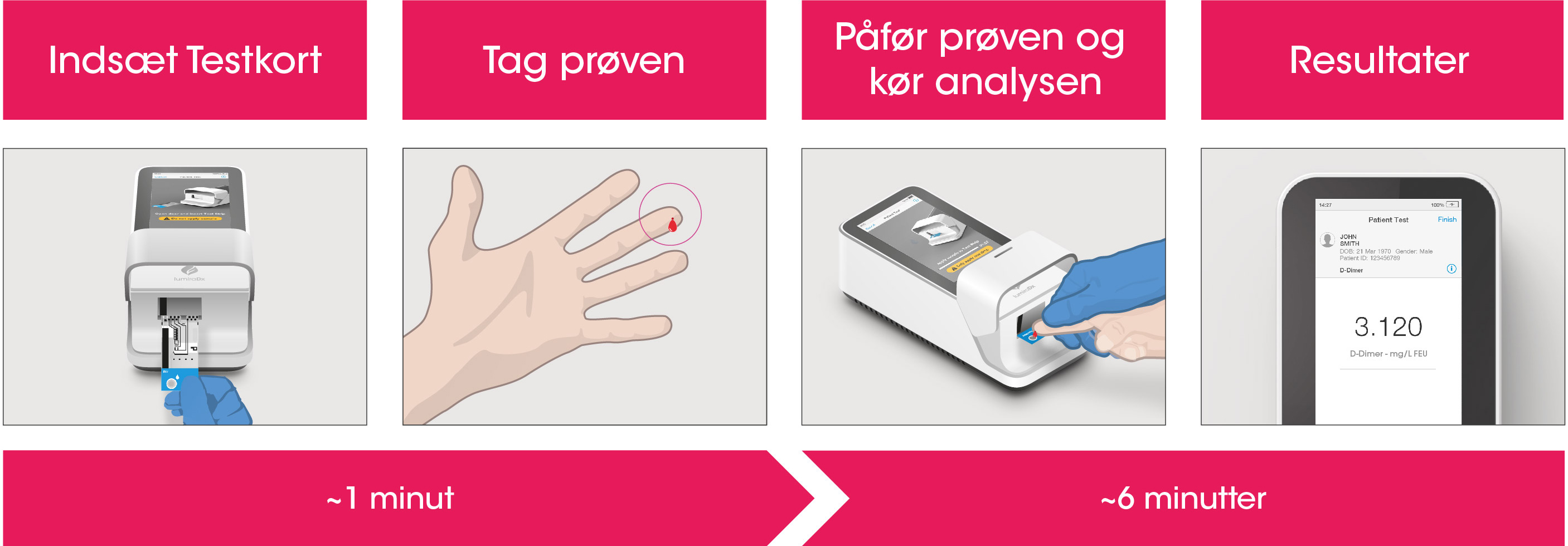 Arbejdsgangsprocessen for D-Dimer Test består af en simpel prøvetagning med en fingerpriklancet efterfulgt af trinvis vejledning af Instrumentet til at rapportere et patientresultat efter 6 minutter fra prøveplacering.